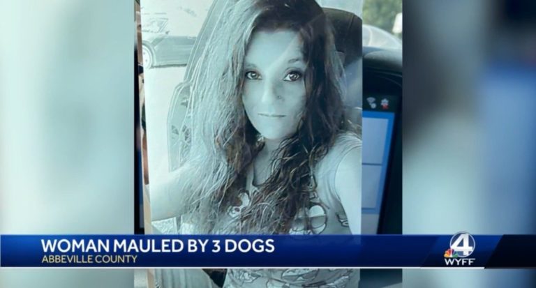 HORROR: South Carolina Mom has Both Arms Amputated After She’s Mauled by Pit Bulls – Dog Owner Charged